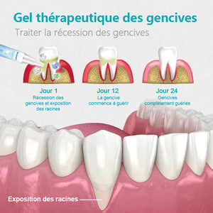 Gel de réparation pour les dents (Achetez 1 obtenez 1 gratuitement)