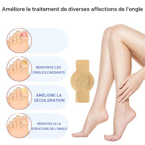 Autocollants pour l'onychomycose