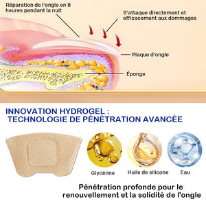 Autocollants pour l'onychomycose