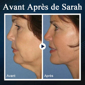 Appareil de beauté du visage en V endormi