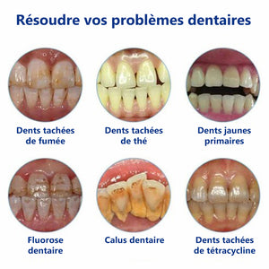 Dentifrice anti-carie pour la santé des gencives