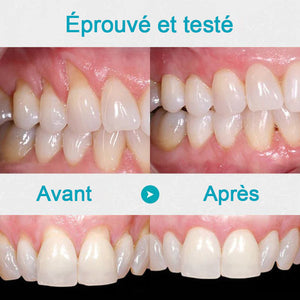 Gel de réparation pour les dents (Achetez 1 obtenez 1 gratuitement)