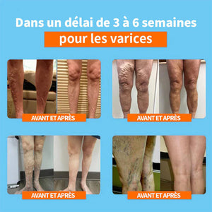 Bas longs en soie Correction Ionique et Détoxification Lymphatique