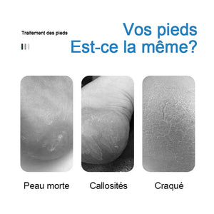 Spray exfoliant pour les pieds