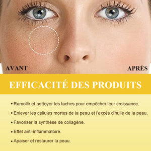 Crème réparatrice pour l'élimination des grammes de graisse