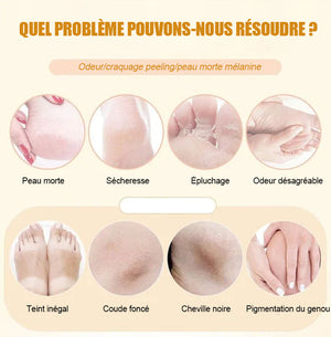 Spray exfoliant pour les pieds