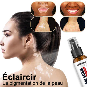Spray pour soulager les taches blanches