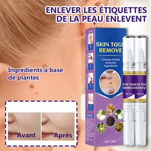 Stylo anti-acrochordons retirer des étiquettes de peau (2 pièces)