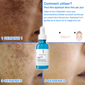 Sérum pour éliminer les taches et de l'acné