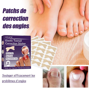 Patchs de correction des ongles