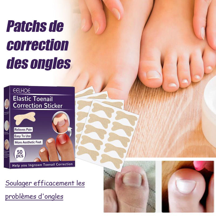 Patchs de correction des ongles