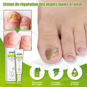 Crème de réparation des ongles mains et pieds-Achetez 1 obtenez 1 gratuitement (2 pièces)