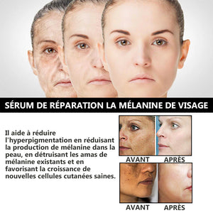 Sérum de réparation la mélanine de visage