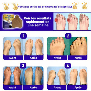 Patch de soulagement des bunions aux herbes naturelles