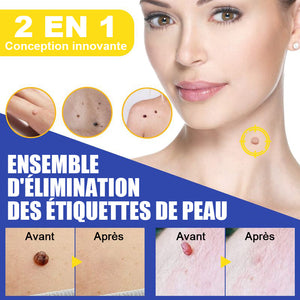 Ensemble d'élimination simple des verrues