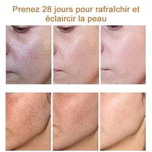 Crème anti-taches de rousseur à la vitamine C