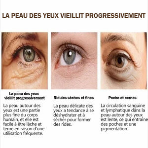 Crème réparatrice des yeux- Éliminer cernes/ rides/ poches des yeux