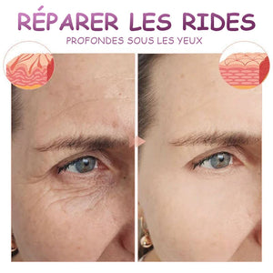 Crème des yeux anti-rides atténuer les ridules