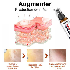 Spray pour soulager les taches blanches