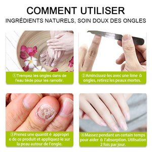 Crème de réparation des ongles mains et pieds-Achetez 1 obtenez 1 gratuitement (2 pièces)