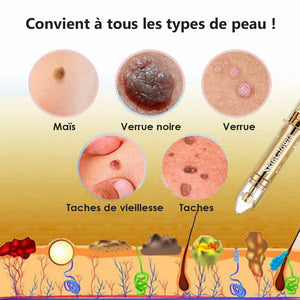 Essence anti-acrochordons et anti-taupes - Achetez 1 obtenez 1 gratuitement (2 pièces)