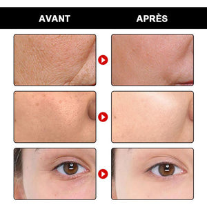 Sérum anti-âge pour le visage (Acheter 1 obtenez 1 gratuitement)
