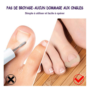 Patchs de correction des ongles