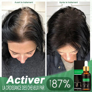 Traitement pour cheveux & Essence Nourrissante