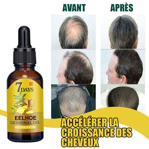 Huile germinale de gingembre pour la repousse des cheveux--Achetez 1 et obtenez 1 gratuit (2 pièces)