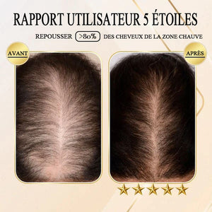 Savon de shampoing au gingembre pour repousser des cheveux (2 pièces)