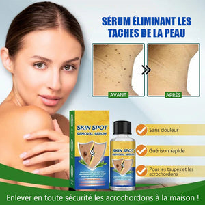 Sérum pour éliminer des grains de beauté (2 pièces)