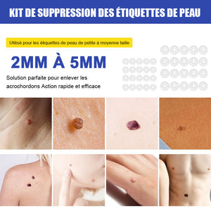 Ensemble d'élimination simple des verrues