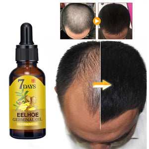 Huile germinale de gingembre pour la repousse des cheveux--Achetez 1 et obtenez 1 gratuit (2 pièces)