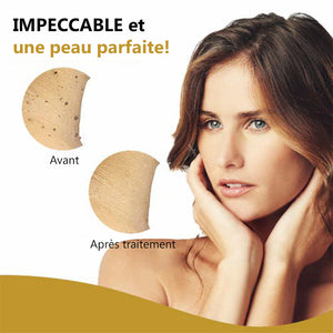 Essence anti-acrochordons et anti-taupes - Achetez 1 obtenez 1 gratuitement (2 pièces)