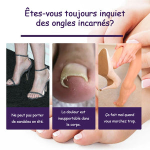 Patchs de correction des ongles