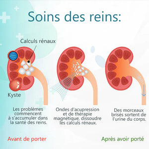 Pinces à acupression de soins rénaux (Achetez 1, obtenez 1 gratuitement)