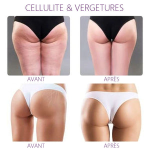Huile essentielle bio Instantanée lifting des hanches
