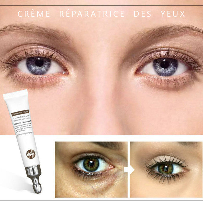 Crème réparatrice des yeux- Éliminer cernes/ rides/ poches des yeux