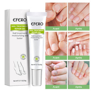 Crème de réparation des ongles mains et pieds-Achetez 1 obtenez 1 gratuitement (2 pièces)