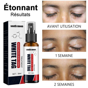 Spray pour soulager les taches blanches