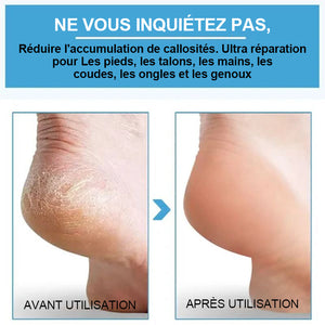 Spray exfoliant pour les pieds