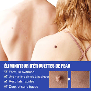 Ensemble d'élimination simple des verrues