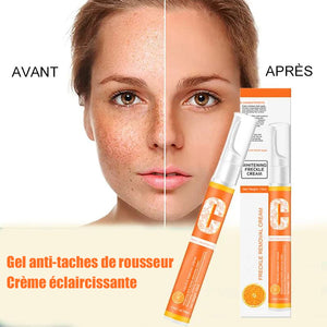 Crème anti-taches de rousseur à la vitamine C