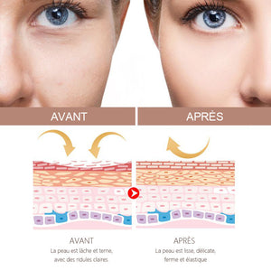 Crème anti-rides pour visage et cou