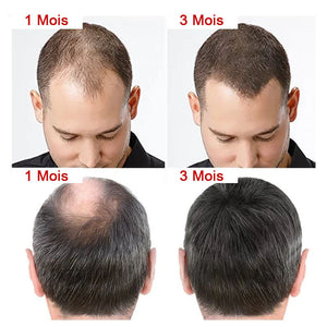 Traitement pour cheveux & Essence Nourrissante