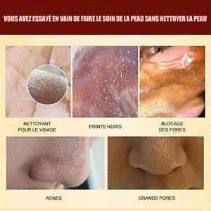 Masque peel-off pour enlever les points noirs